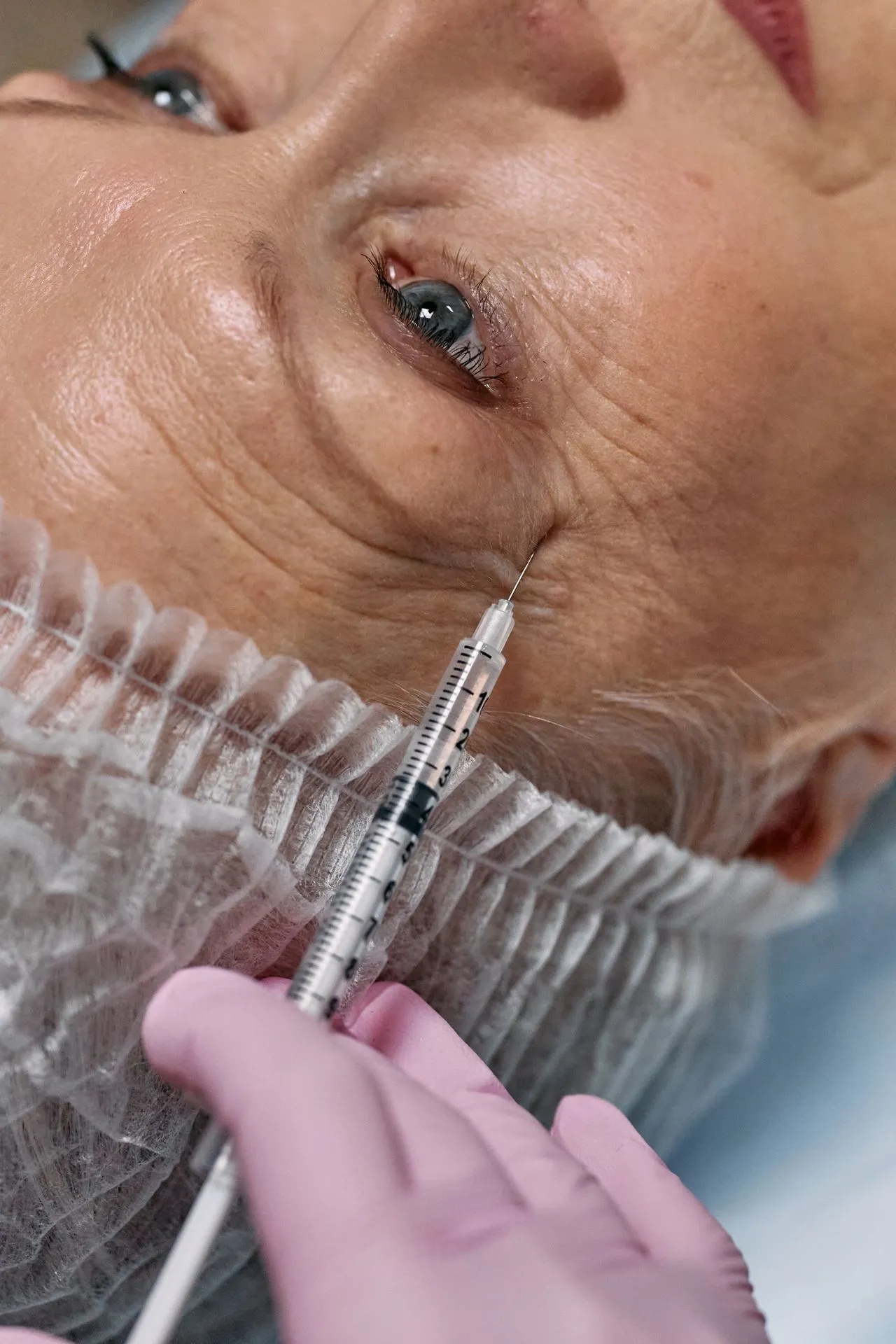 Botox injection treatment at Ample West Hartford CT